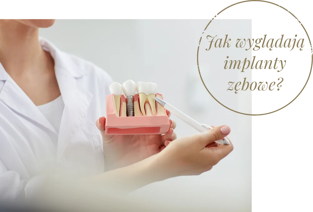 Implanty zębów Poznań